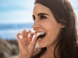 Invisalign vs Braces