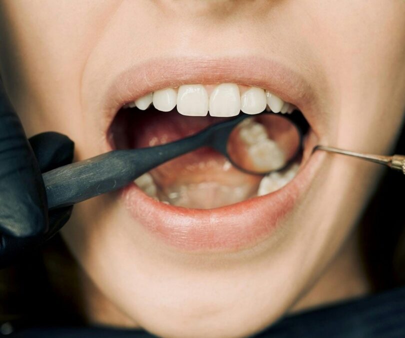 dental anxiety