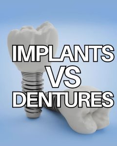 Implants vs Dentures at Fleckney Dental & Cosmetic Clinic