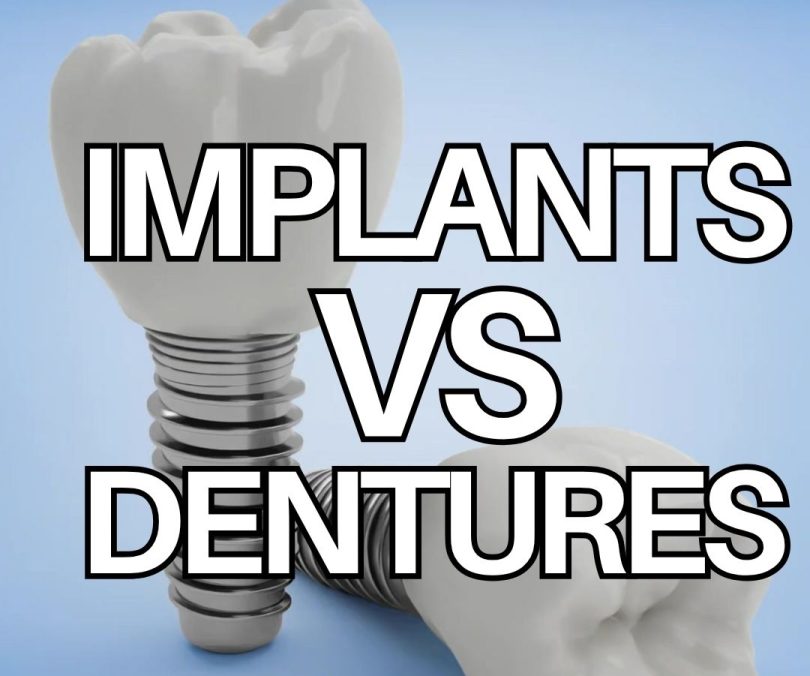 Implants vs Dentures at Fleckney Dental & Cosmetic Clinic